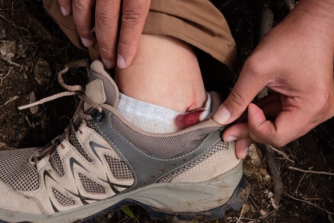 cầm máu là kỹ năng đi trekking vô cùng quan trọng